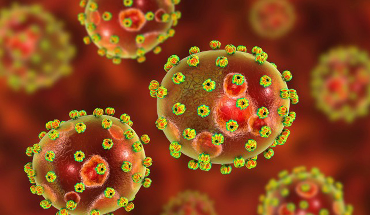 Two cases of Ebola-like virus Lassa Fever detected in England
